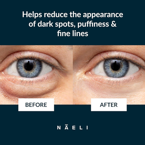 NAELI Eye Cream for Dark Circles, Puffiness & Wrinkles, Anti Aging Apple Stem Cell & Peptide Complex, 1.4 oz