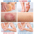 Ingredients-50g Athletes Foot Treatment-Antifungal Cream-Treatment for Jock Itch,Ringworm, Psoriasis,Eczema,Rash-Anti