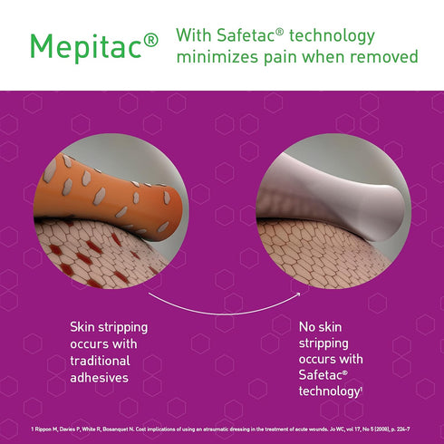 Mepitac Soft Silicone Tape, 2 cm x 3 /0.8 in x 3.3 yd, Model 298300