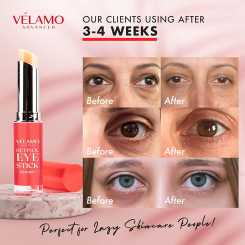 Retinol Eye Stick & Cream, Under Eye Anti Aging Cream, Brightening Eye Balm Reduces Fine Lines & Dark Circles
