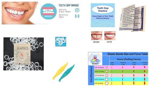 IVORIE Cosmetic Dental Lab Elastic Rubber Bands for Braces Teeth Gap Alignment, 60pcs (5/16" Penguin 6.5oz)