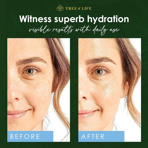 Tree of Life Hyaluronic Acid Serum for Face, 2 Fl Oz, Hydrating Anti-Aging Serum
