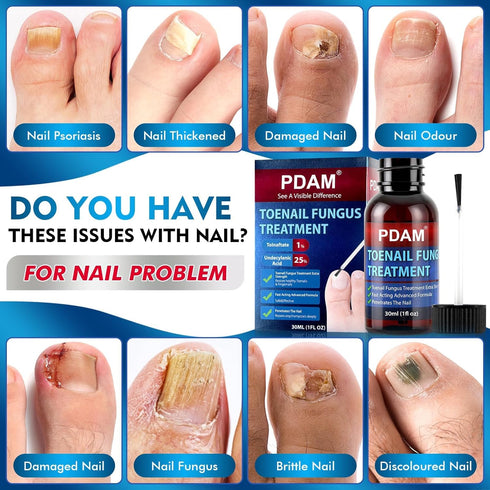 PDAM 30ml Toenail Fungus Treatment Extra Strength - Toe Nail Fungus Treatments for Thick, Nail Strengthener and Growth