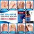 PDAM 30ml Toenail Fungus Treatment Extra Strength - Toe Nail Fungus Treatments for Thick, Nail Strengthener and Growth