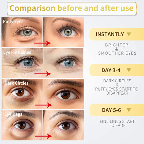 Under Eye Patches, 60 Pcs 24K Gold Eye Mask for Puffy Eyes & Dark Circles, Collagen & Hyaluronic Acid