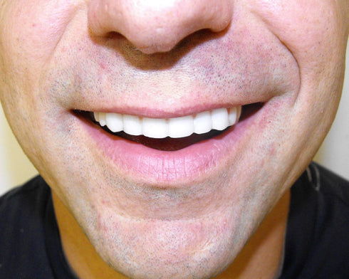 Instant Smile Comfort Fit Flexible Lower Teeth