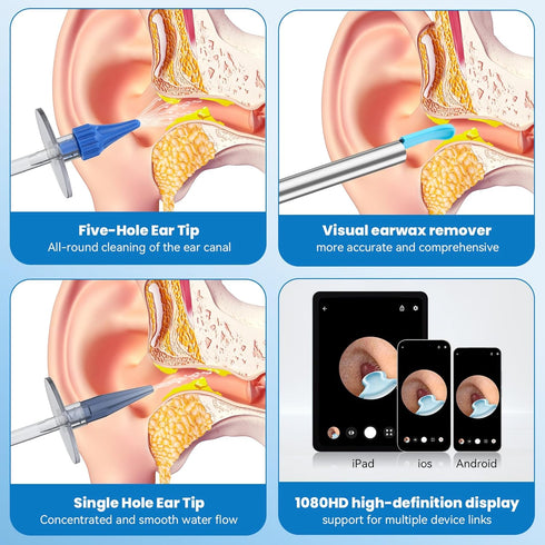 Ear Wax Removal Kit - Ear Cleaner with Camera - 1080HD Tool for Effective Cleaning of Ear Wax Build-Up