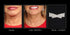 NeckTITE Magic - The Instant Neck Lift