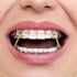 JMU Orthodontic Elastics 3/8 Heavy, 300 Pack of Rubber Bands, Intraoral Latex Dental Bands