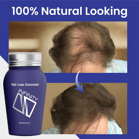 INFINITY Hair Fibers Dark Brown - 100% Undetectable Hair Building Fiber Powder, 15g