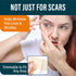 NUVADERMIS Silicone Scar Sheets, Extra Long Reusable Medical Grade for C-Section, Tummy Tuck, Pack of 4 - Light Tone