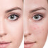 Quick Clear Blemish Control Acne Spot Treatment, Drying Lotion for Face, Back, Chest