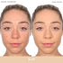 Almay Clear Complexion Acne Foundation Makeup with Salicylic Acid, Lightweight Medium Coverage for Sensitive Skin, 200