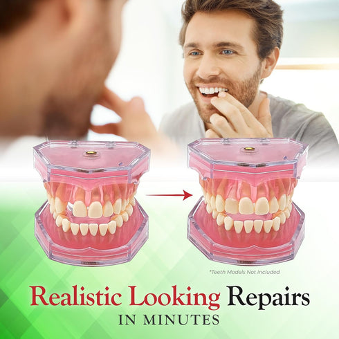 SmileFix Basic Dental Repair for Missing or Damaged Teeth - Fast & Easy Repairs - Durable Compound - Confident Smiles