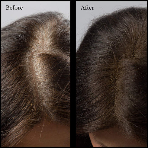 Root Touch Up Powder, True-to-Nature Hairline Concealer with 11 Shades, Fragrance-Free, Dark Brown