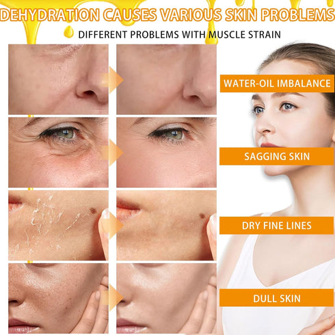 8 Pack Honey Sheets Face Mask Set - Moisturizing Facial Masks for Men & Women, Hydrating for All Skin Types