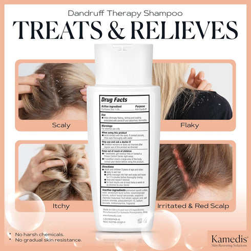 KAMEDIS Anti Dandruff Shampoo 6.7 Fl Oz for Women & Men | Seborrheic Dermatitis Treatment for Itchy, Red Scalp & Flaky
