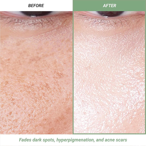 Meebak Korean Vitamin C Serum, Brightening Dark Spot Remover with Centella Asiatica and Panthenol