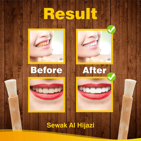 Pack of 12 Miswak Sticks - Natural Toothbrush for Teeth Whitening and Fresh Breath, Organic Wooden Vacuum Sealed