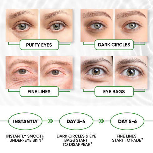 Under Eye Mask for Puffy Eyes & Dark Circles - 60 Gel Pads, Hydrating Collagen Eye Patch Treatment