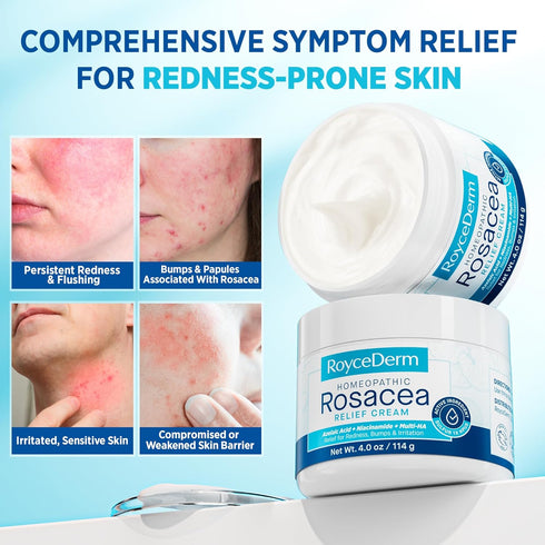 Roycederm Rosacea Treatment for Face with Azelaic Acid Redness Relief & Corrector Sensitive Skin Moisturizer