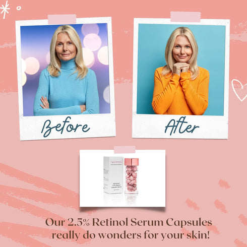 Pure 2.5% Retinol Serum Capsules, Powerful Anti-Aging, Deep Hydration, Brightening, Reduce Acne & Wrinkles (30 Count)