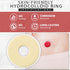 MED Supplies Is Us 2 48mm 10 Ostomy Medical Supplies Barrier Ring Barrier Rings Box of by