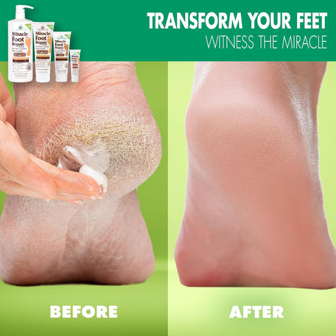 Miracle Foot Repair Cream, 4 oz, Repairs Dry Cracked Heels, Diabetic-Safe, Moisturizes and Softens Feet, 2-Pack