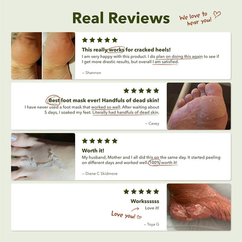 Purederm Shiny & Soft Foot Peeling Mask (6 pack), Exfoliating Peel Off for Smooth Baby Skin