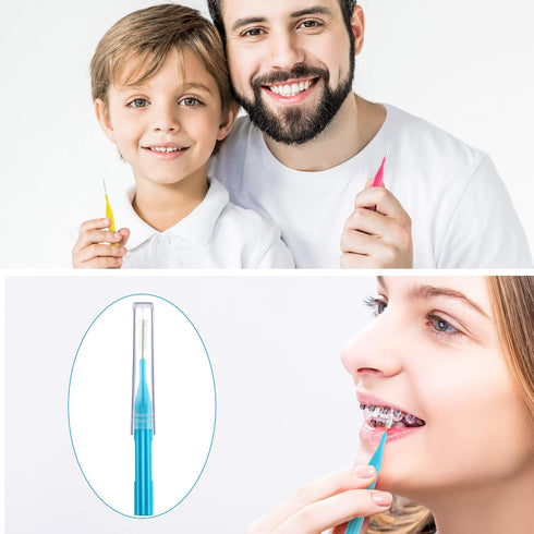 100 Pieces Braces Brush for Cleaner Interdental Brush Toothpick Dental Hygiene Flosser (Light Blue, Pink, Yellow, Light