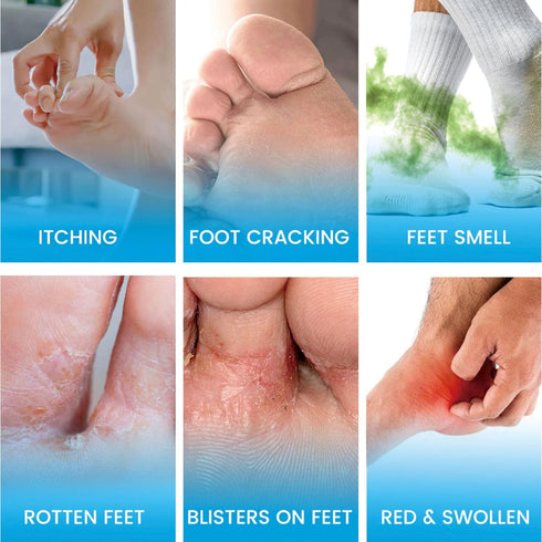 SERYNTH Odor100ML Foot And Shoe Spray Antifungal,Foot Fungus Spray,Athlete Foot Spray,Itchy Feet Treatment,Foot Treat