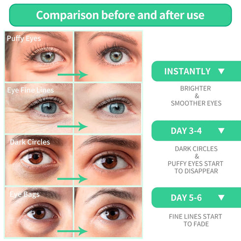 BREYLEE Aloe Vera Eye Mask 60 Pcs for Puffy Eyes and Dark Circles, Reduce Wrinkles and Fine Lines, Natural Material