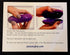 Pessary Box Discreet Pessary Storage case Container with Vented lid and Personal Lubricant Clip