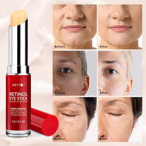 Retinol Eye Stick, Cooling & Brightening Cream for Dark Circles, Puffiness, PEPTIDES 5% Hyaluronic Acid Complex, SPF 30+