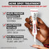 Thayers Rapid Acne Treatment with 10% Sulfur, Sulfur Acne Treatment with Niacinamide and Glycolic Acid, Soothing and Non-Stripping Skin Care, 0.68 Fl Oz