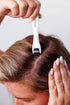 REVIVV Dermaroller Tool for Hair Rejuvenation | Hair Follicle Stimulator | Beard Kit | 0.25mm Micro Needle for Scalp
