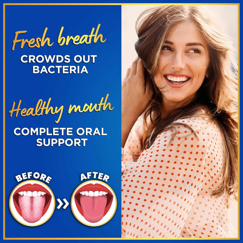 Oral Probiotics for Teeth and Gums, 45 Chewable Mint Tablets for Bad Breath Treatment, 3BN CFU