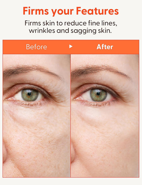 It'S SKIN Collagen Nutrition Emulsion, 5.07 fl. oz., Marine Collagen Facial Lotion for Aging Skin