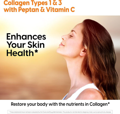 Doctor's Best Collagen Types 1 & 3, Non-GMO, Gluten Free, 1000 Mg, 540 Tablets, Supports Hair, Skin, Nails