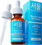 SeoulCeuticals Korean Acne Serum 1oz - Skin Care Treatment for Acne Prone Skin with Salicylic Acid, Tea Tree & Clove