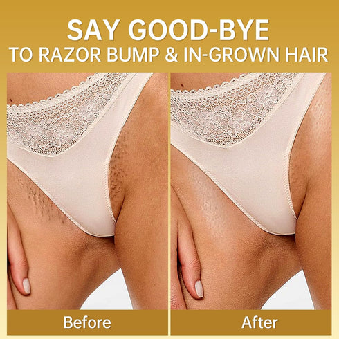 LA.PERSONAL Ingrown Hair Treatment Oil for Men and Women, Razor Bump Remover for Bikini and Legs