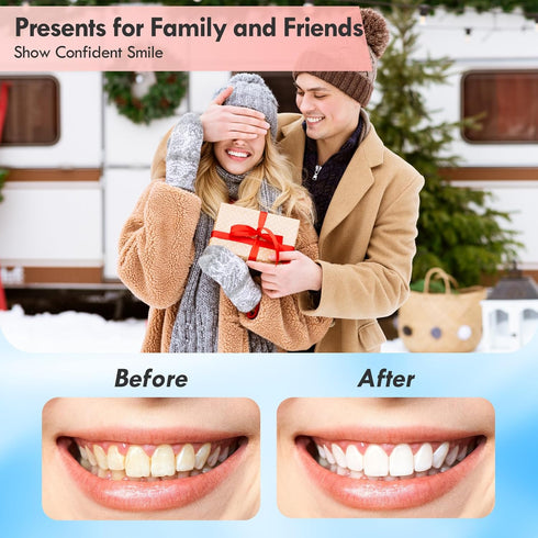 Rechargeable Tooth Polisher Kit - Electric Dental Teeth Polisher with LED Light, 5 Brush Heads