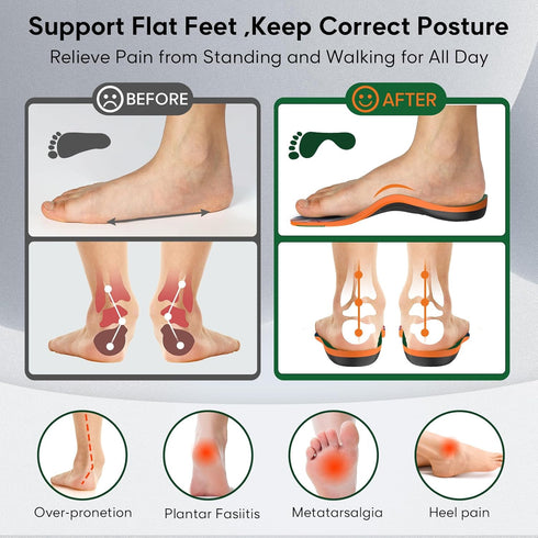 Flat Feet Arch Support Insoles - Extra Comfort Gel Cushion Metatarsal Pad - Pain Relief for Standing & Walking -