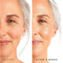 Tree of Life Retinol Serum for Face - Hydrating Hyaluronic Acid for Wrinkle Soothing, 4 Oz Nighttime Serum