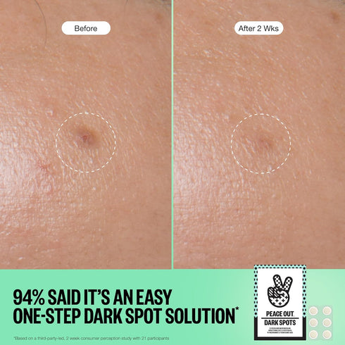 PEACE OUT Microneedling Dark Spot Brightening Dots