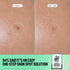 PEACE OUT Microneedling Dark Spot Brightening Dots