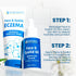 Inflammation (1 50g) Grahams Natural Face & Eyelid Eczema Cream - Treatment for Eczema, Dermatitis, Itch Relief