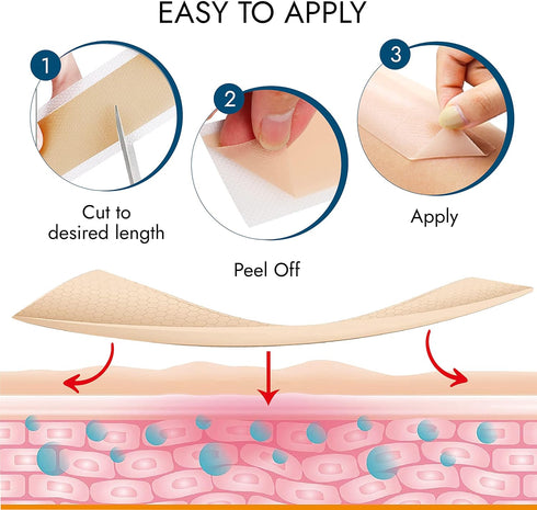 Scarbandit Silicone Scar Sheets - Treatment for Keloid, Tummy Tuck, Burns, Hypertrophic & Surgical Scars