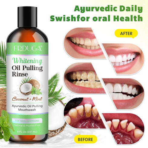 Coconut Oil Pulling for Teeth and Gums, 237ML, Coconut + Mint Mouthwash Pulling Oil for Improved Oral Hygiene