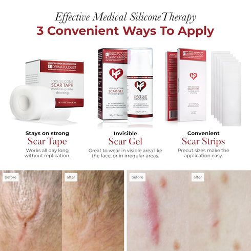 HealFast Physician Formulated Silicone Scar Sheets - Advanced Crosspolymer Medical Grade Silicone Scar Tape